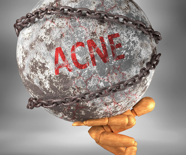 Does Masturbation Cause Acne?